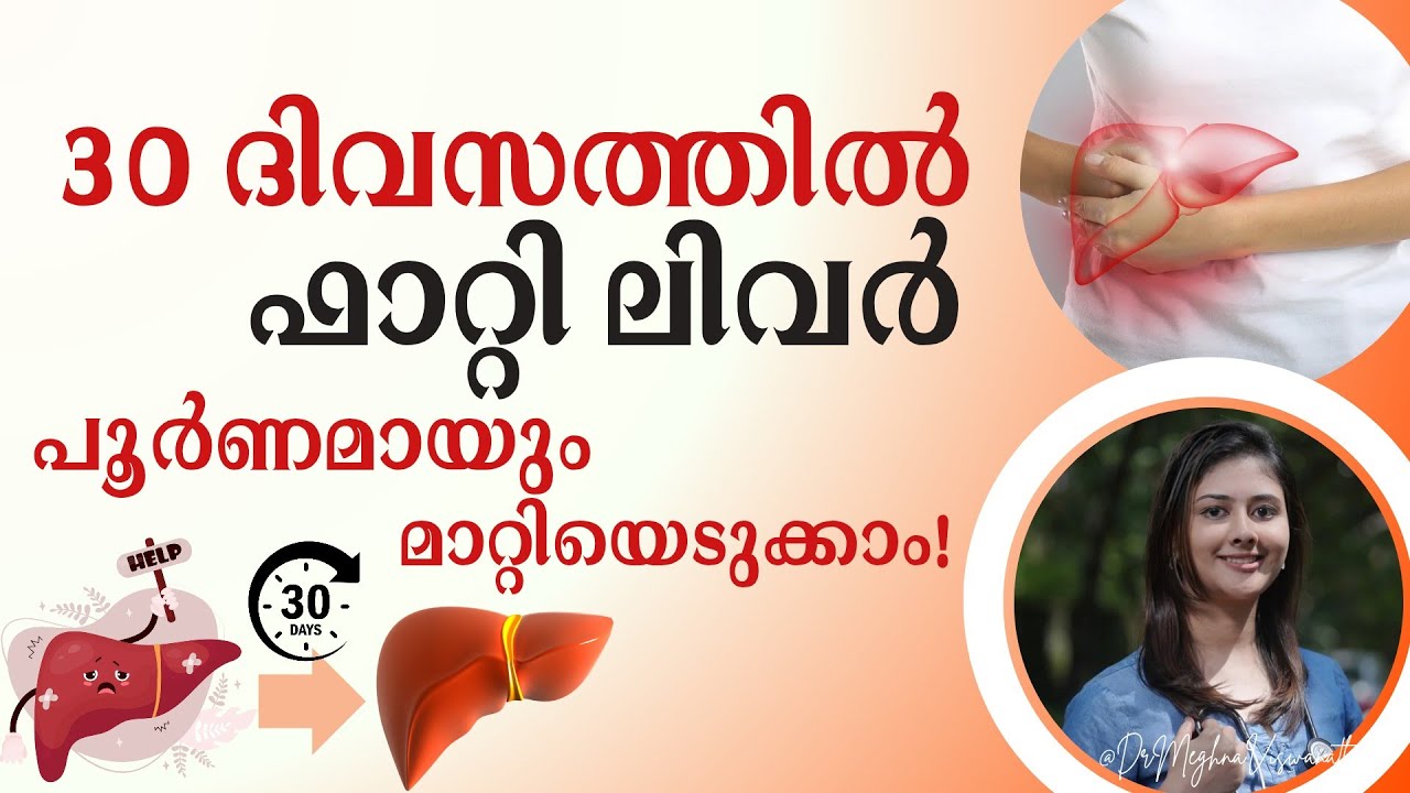 1 മാസം കൊണ്ട് ഫാറ്റി ലിവർ പൂർണമായും മാറ്റിയെടുക്കാം! Fatty liver reversal to normal!