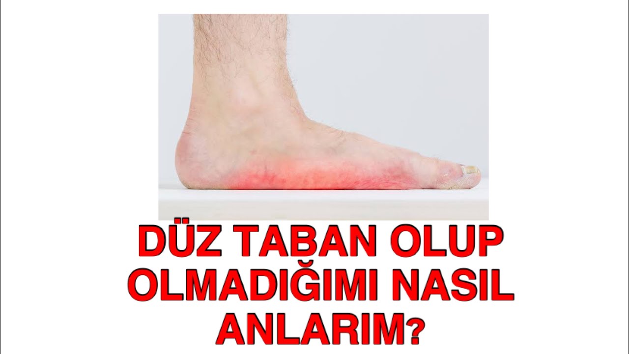 DÜZ TABAN OLUP OLMADIĞIMI EVDE NASIL ANLARIM?