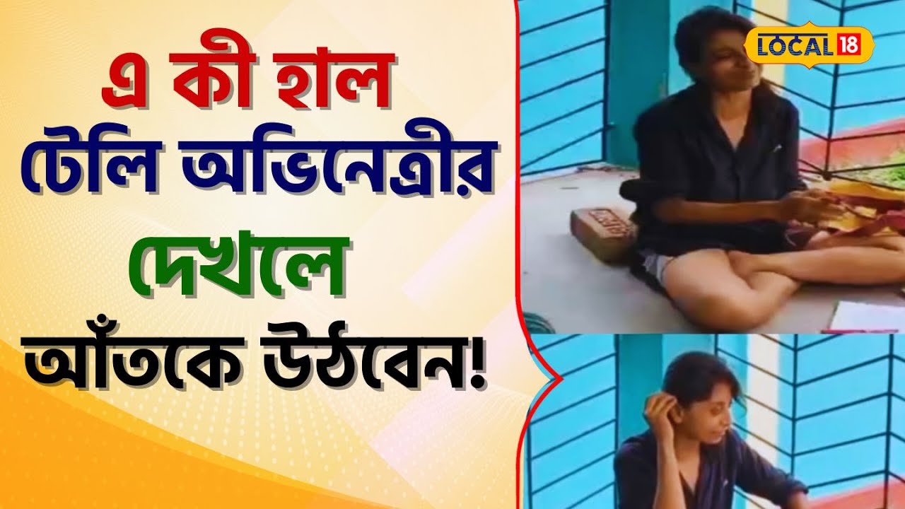 Bangla News: এ কী হাল হল জনপ্রিয় টেলি অভিনেত্রীর! দেখলে আঁতকে উঠবেন! #local18 | Tele Actress