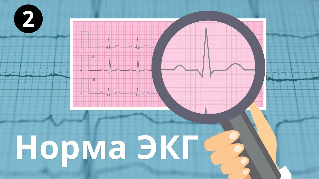Норма ЭКГ. Все интервалы и зубцы: p, QRS, T, PR, ST