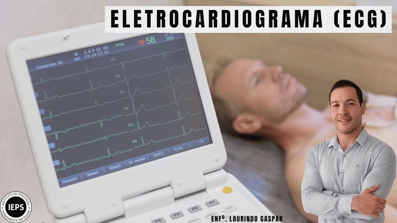 Eletrocardiograma (ECG)