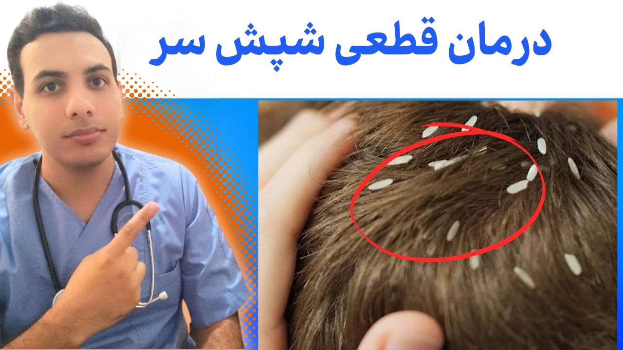 شپش موی سر را در خانه درمان کن | Treat head lice at home