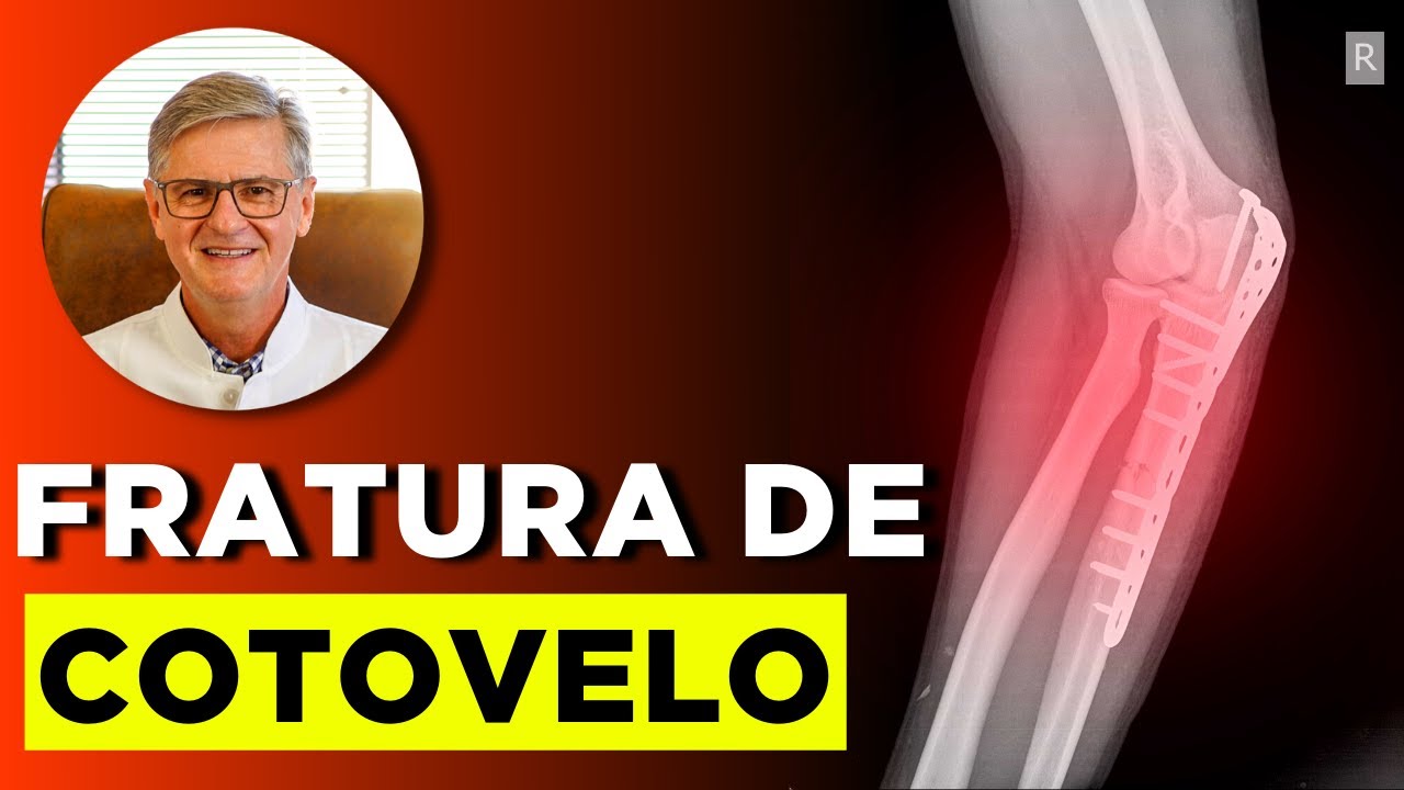 FRATURA DE COTOVELO (Fratura de Olécrano) | Sintomas, Diagnóstico e Tratamento