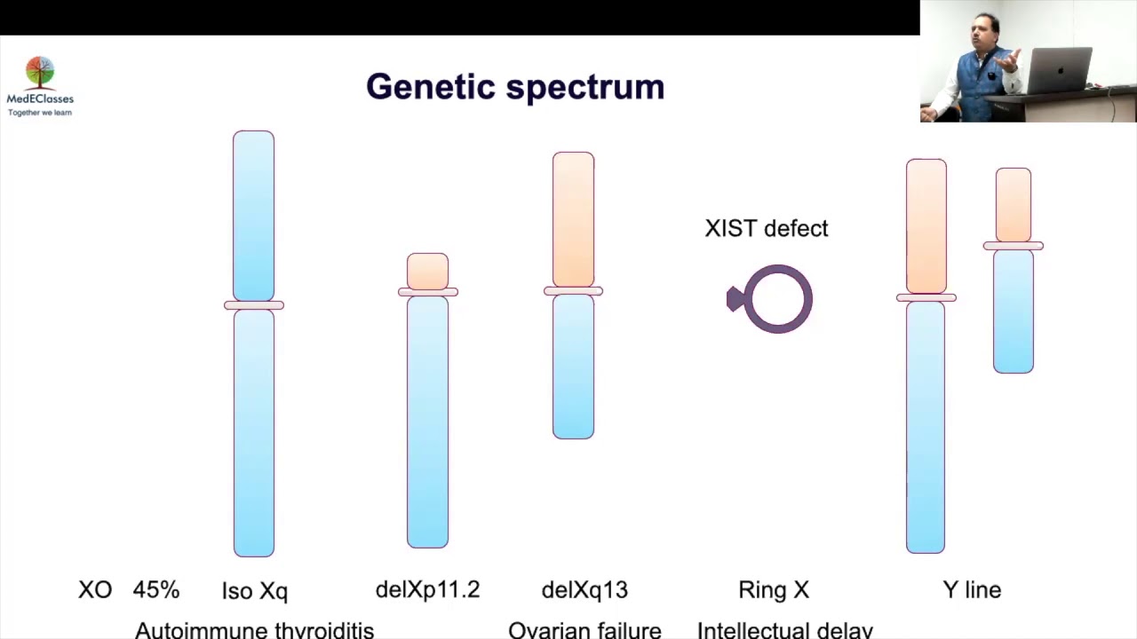 Turner syndrome genetics