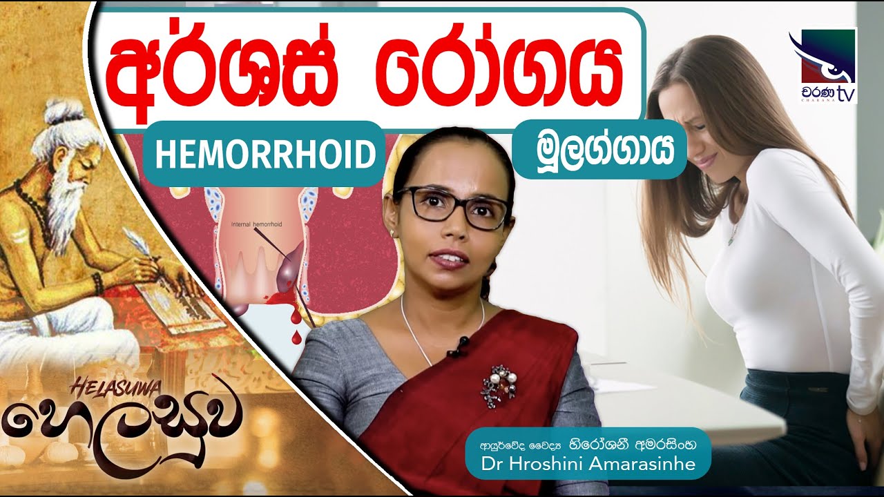අර්ශස් ( HEMORRHOID ) හෙවත් මූලග්ගාය