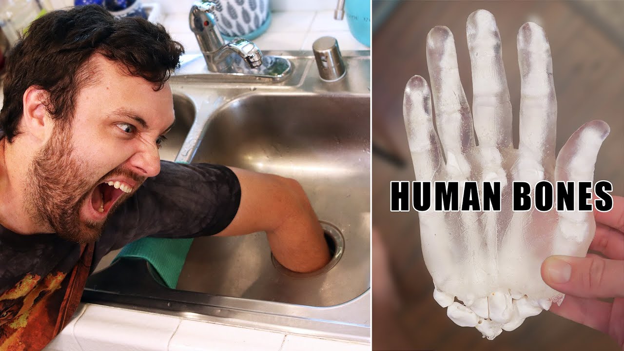 What Happens if You Put Your Hand in a Garbage Disposal?