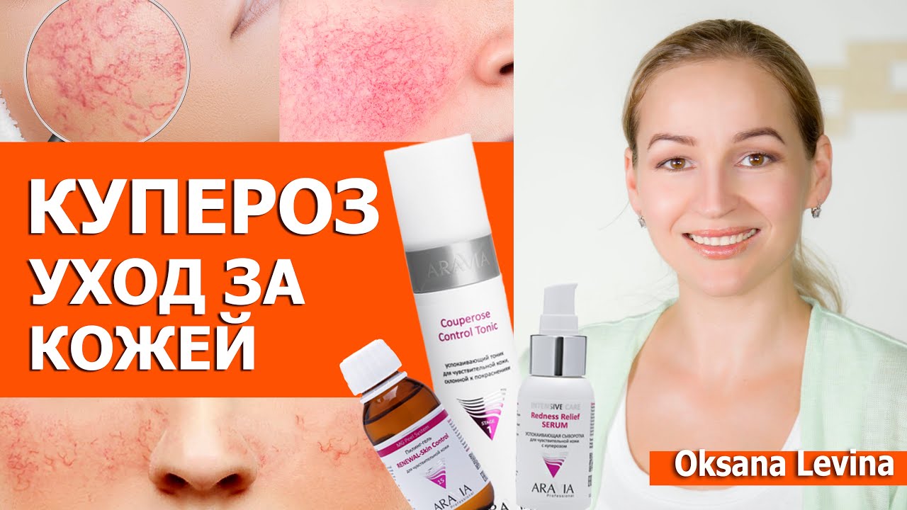 Как уменьшить КУПЕРОЗ. Уход за кожей при куперозе. Массаж и Пилинг при куперозе