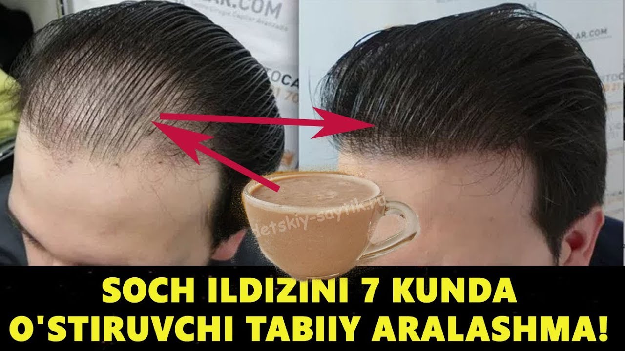 Соч Илдизларини 7 Кунда Устириш