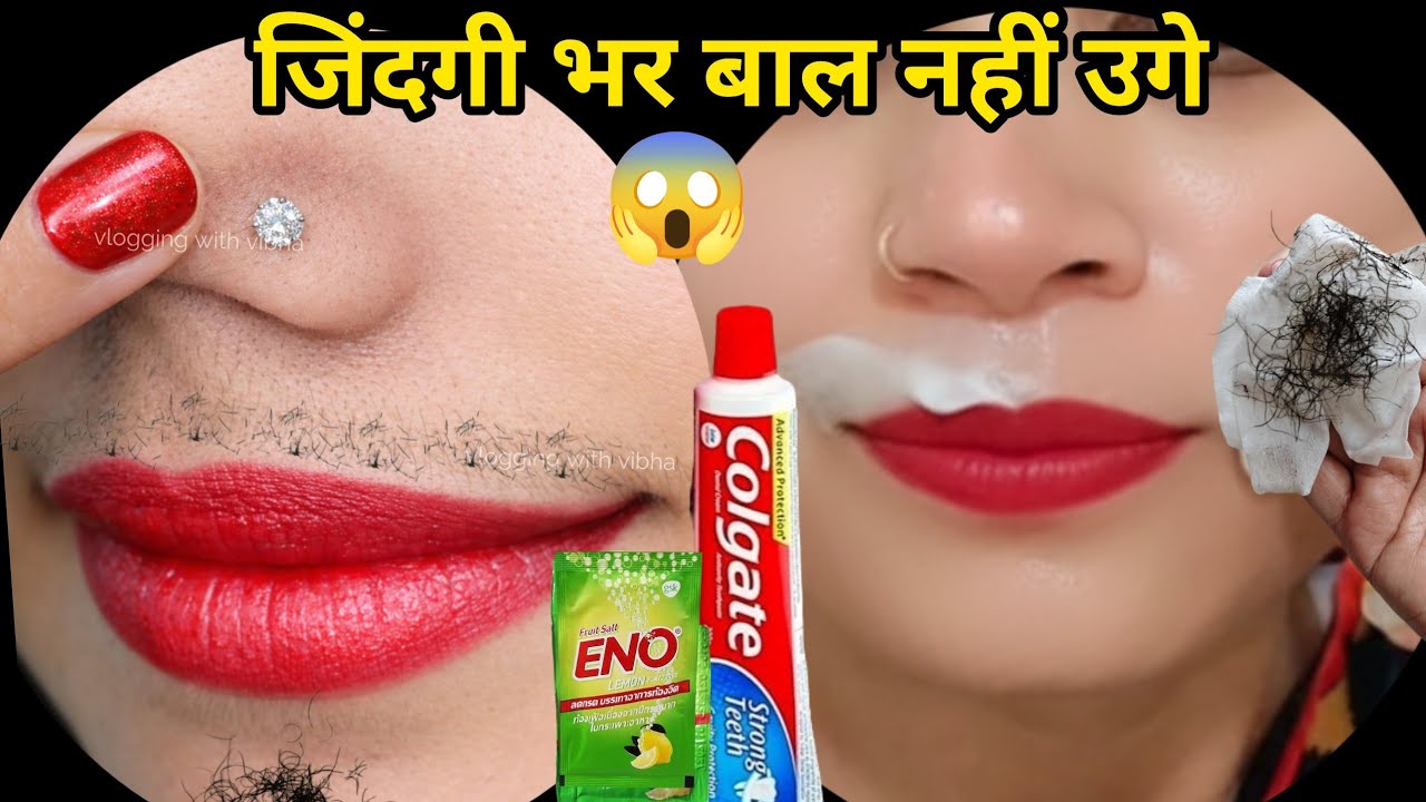 बिना Wax👉दो बूंद लगते ही 44 साल भाभी जी के चेहरे से दाढ़ी,मूछ साफ😱|| facial hair treatment in Hindi