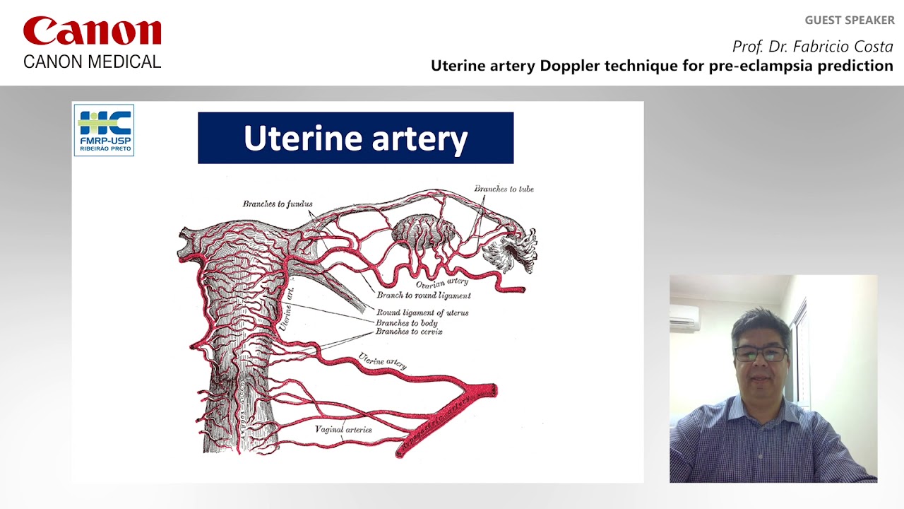 ISUOG 2020 Fabricio Costa – Uterine artery Doppler technique for pre-eclampsia prediction