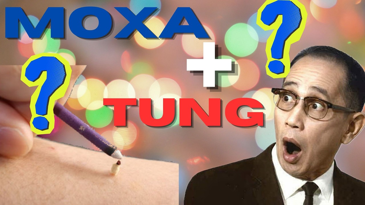Migraine like Symptoms — Tung 's 55.06 With Moxa Made the Difference (Full-Burn Demonstration)