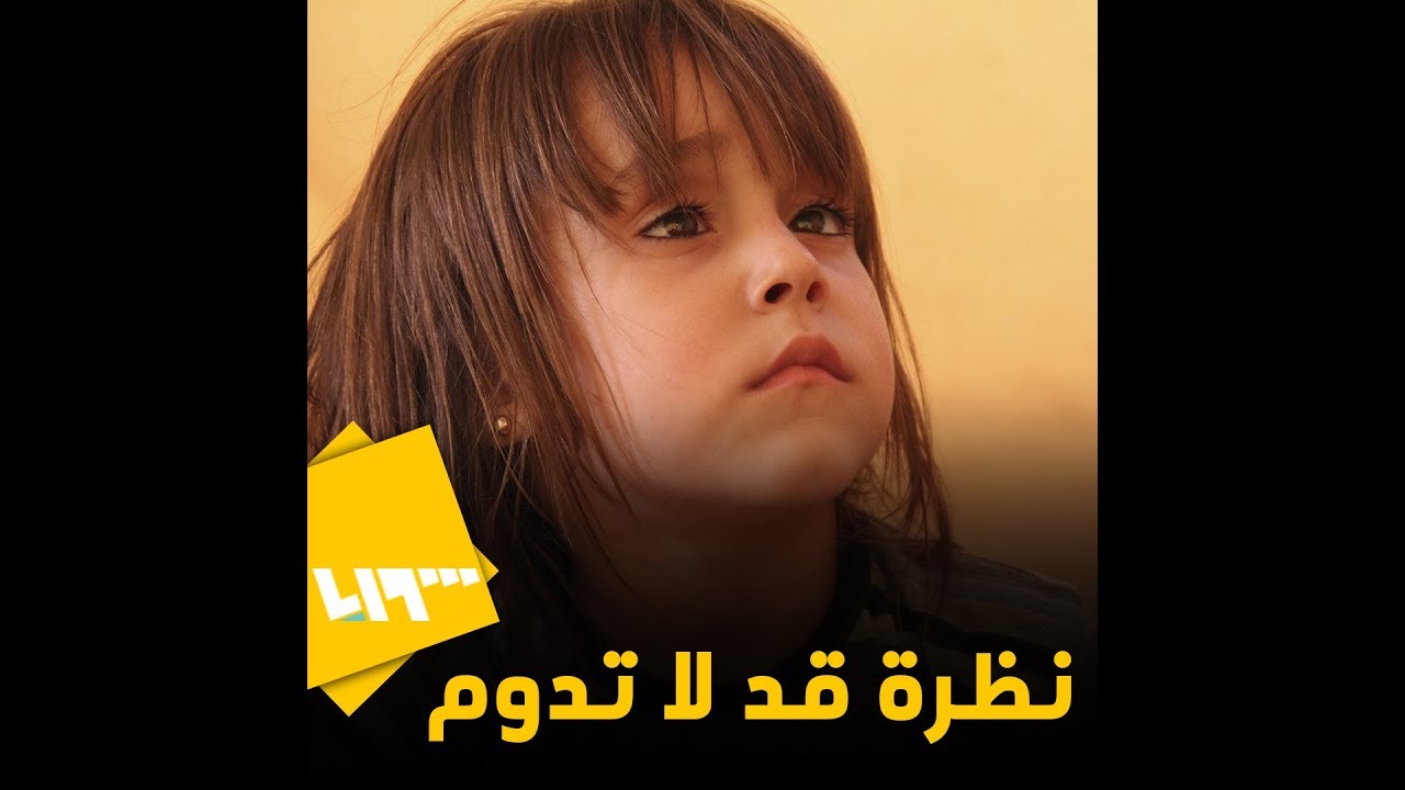 زواج الأقارب أحد الأسباب.. ٣ أطفال مهددون بفقدان البصر