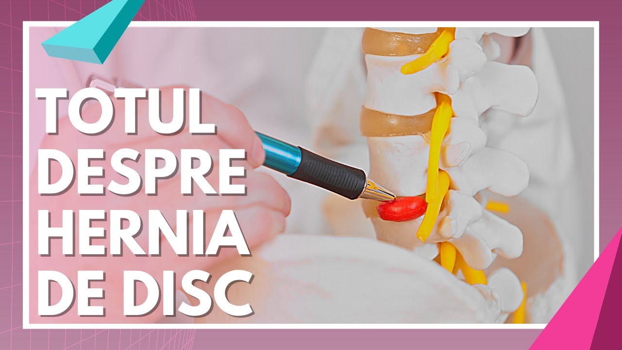 Ce trebuie sa facem pentru a trata HERNIA DE DISC | Alexandru Ilie | Sănătate cu prioritate