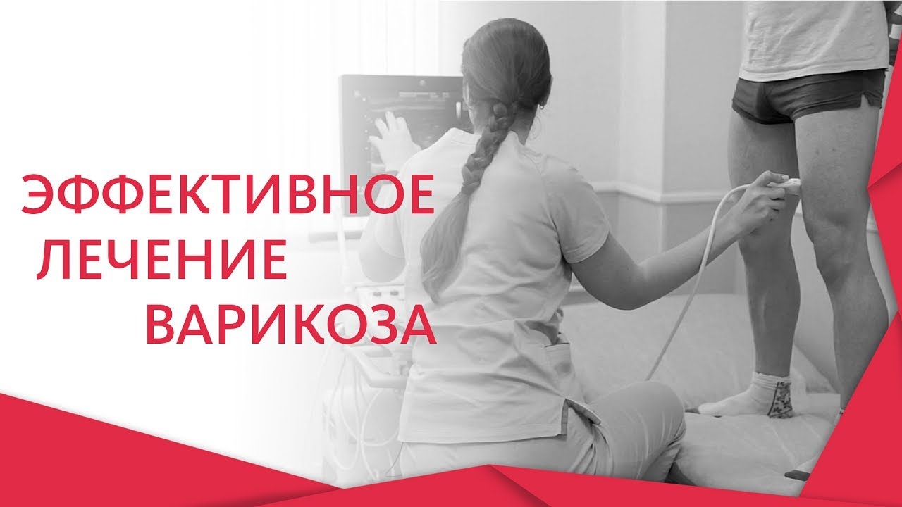 Болят вены на ногах. 👣 Что делать, если болят вены на ногах? Альфа &mdash; Центр Здоровья. 12+