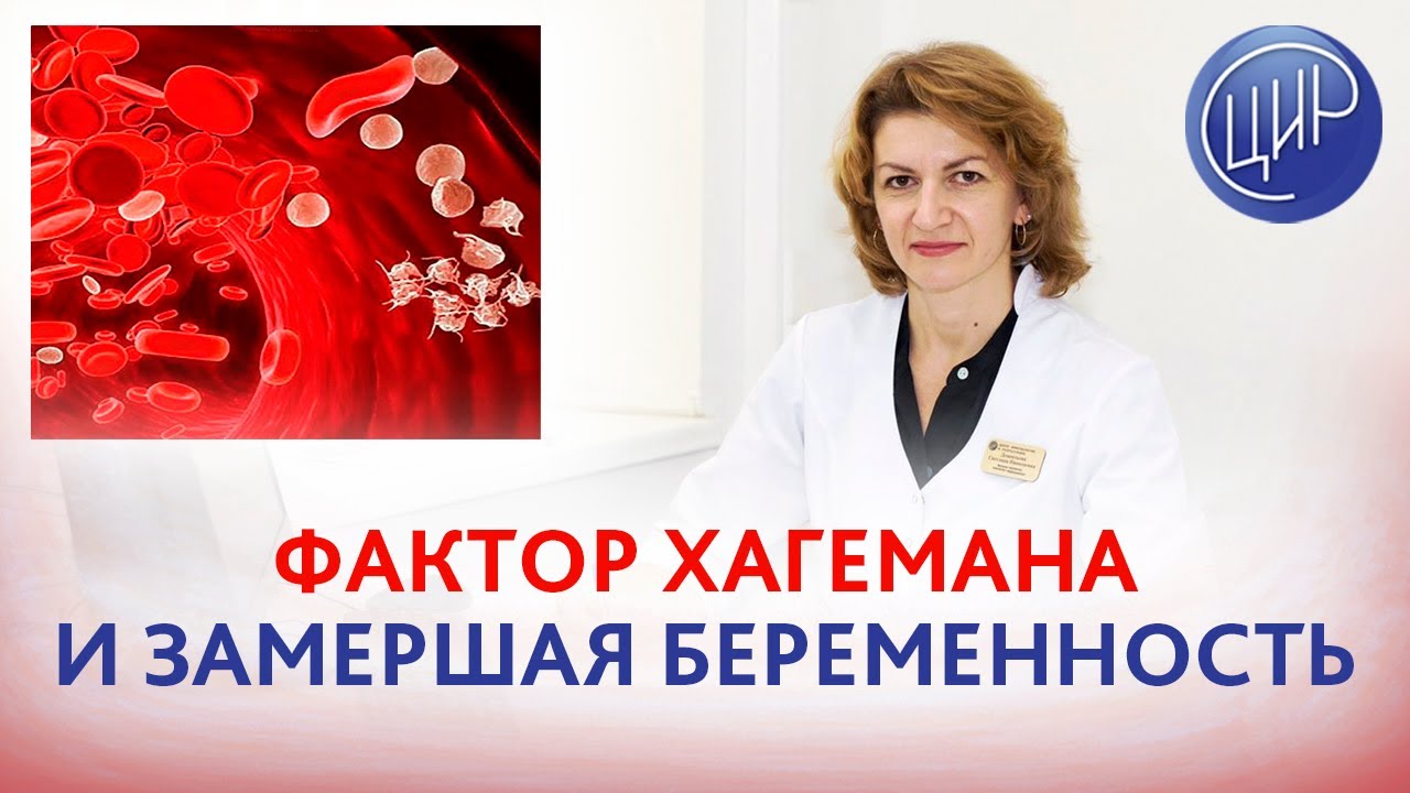 Фактор Хагемана и замершая беременность на ранних сроках. Дементьева С.Н.