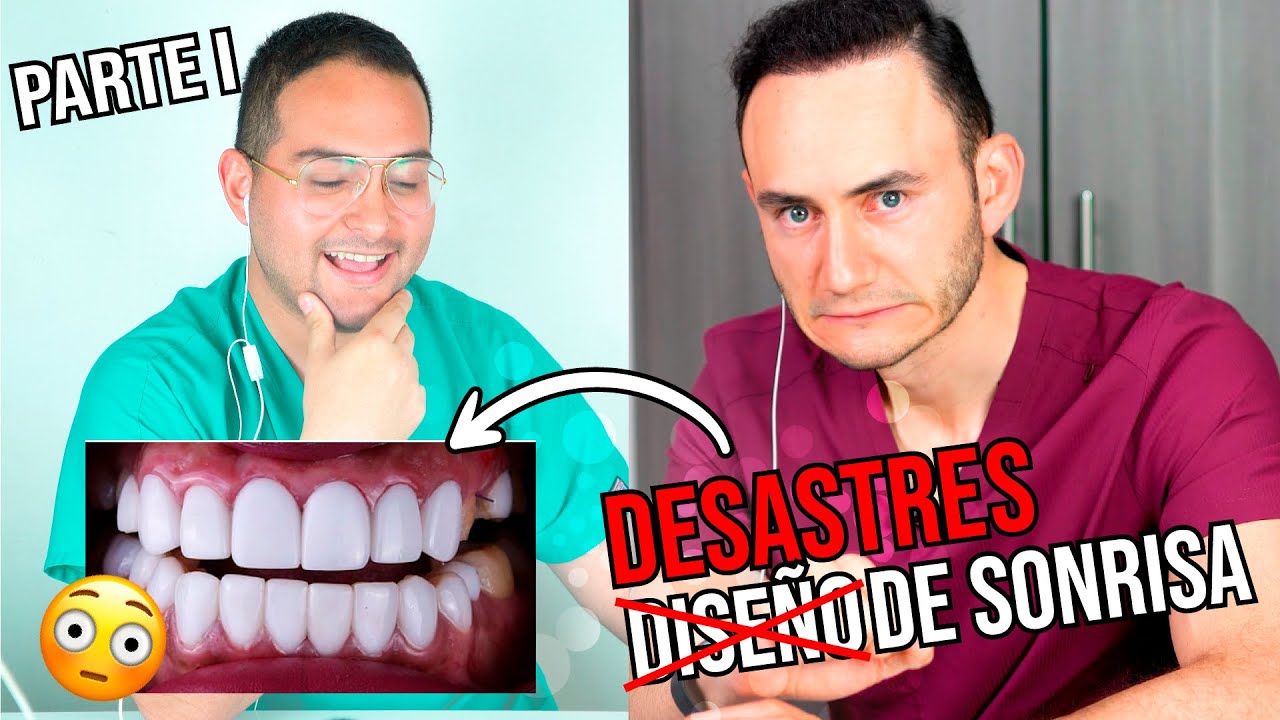 Así NO se hace un DISEÑO DE SONRISA. Ft Dr. Federico Baena 😱 PT.1 #Reacción
