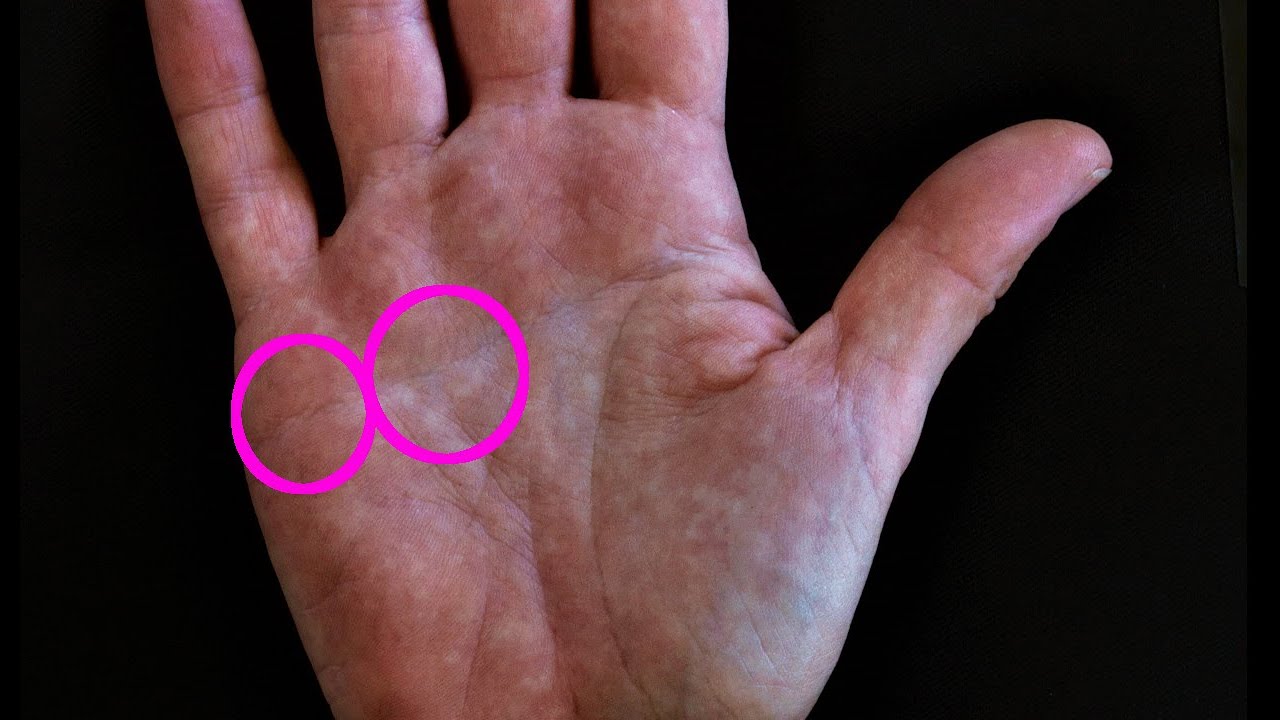 Why does my ACHY BUTT show in my HANDS | Palm Reading