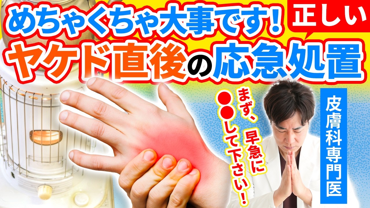 【ヤケドの応急処置】やけどした時どうする？知らないと跡が残る！？皮膚科専門医が教える自宅でできる正しいやけどの応急処置と市販薬の選び方