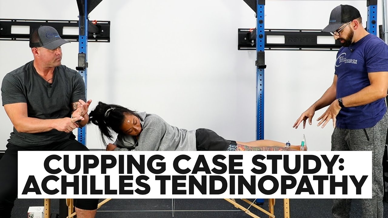 Cupping Case Study: Achilles Tendinopathy