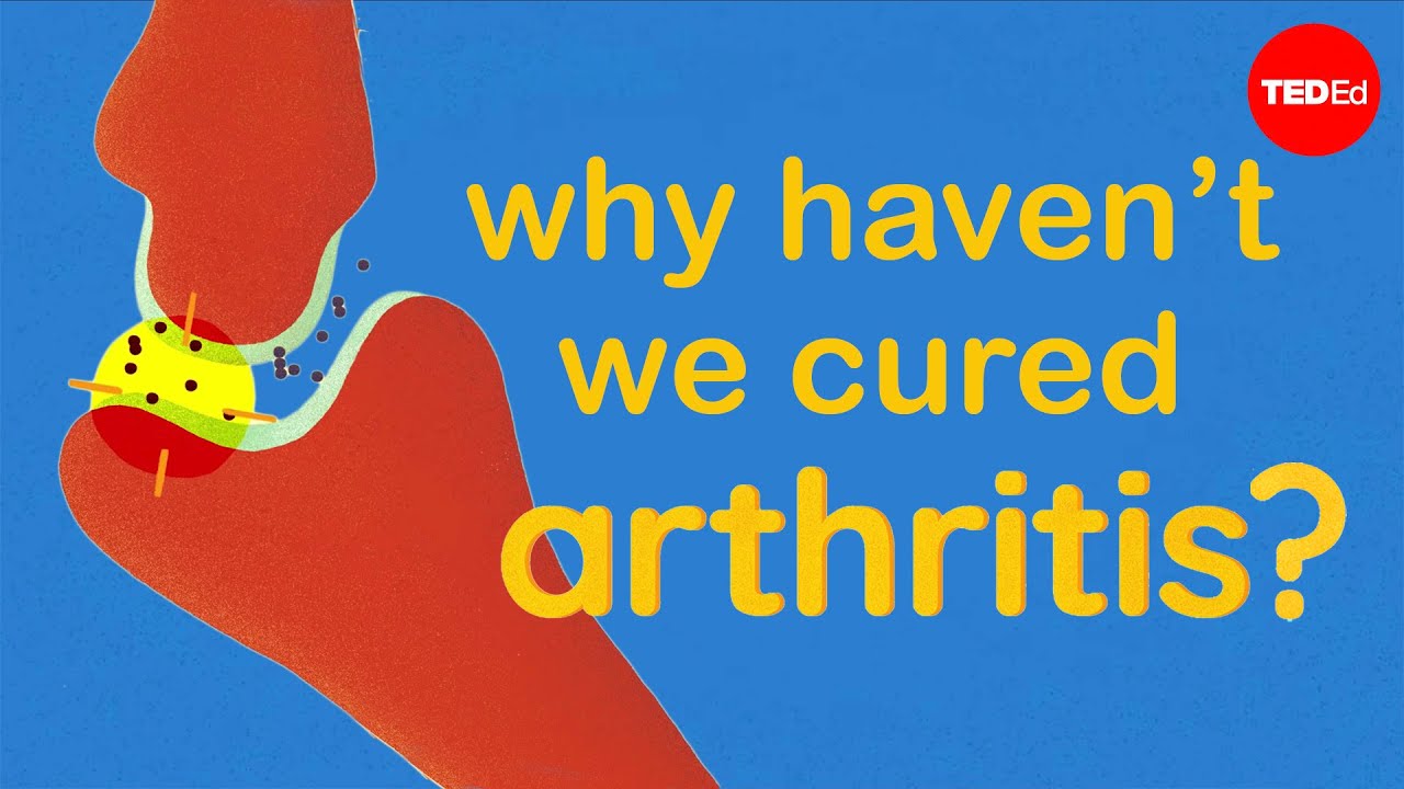 Why haven&rsquo;t we cured arthritis? - Kaitlyn Sadtler and Heather J. Faust