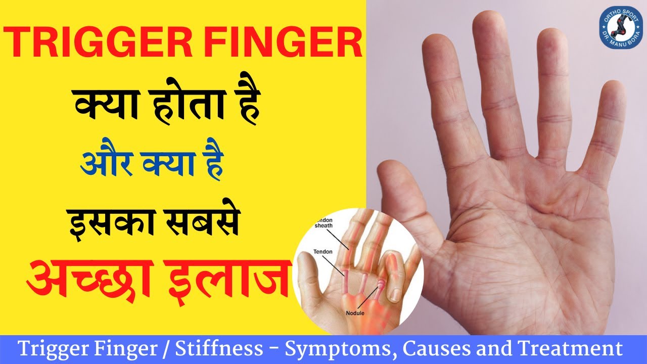#Trigger Finger क्या होता है और क्या है इसका सबसे अच्छा इलाज, Symptoms, Causes and Treatment