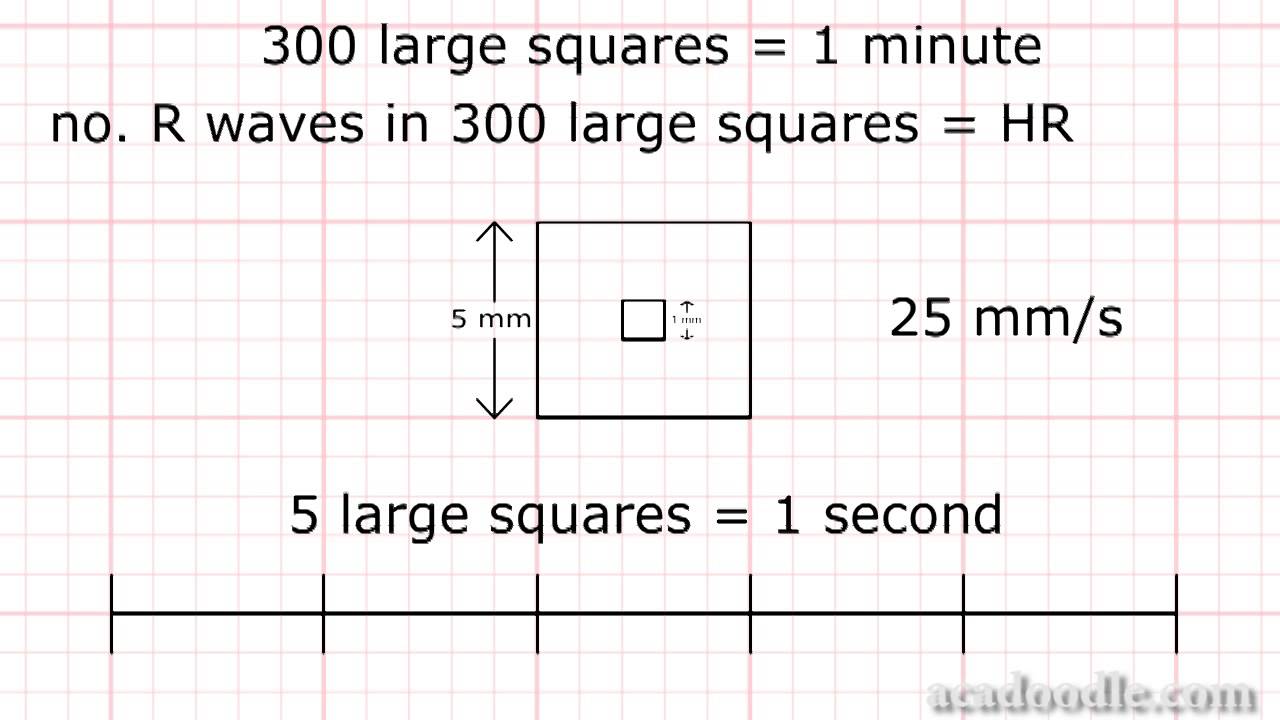 ECG Interpretation - Time and the ECG - Part 1