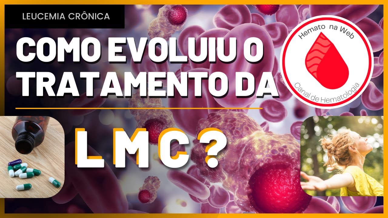 O que é a LEUCEMIA MIELOIDE CRÔNICA? Do diagnóstico ao tratamento | Geydson Cruz; MD,MSc #lmc