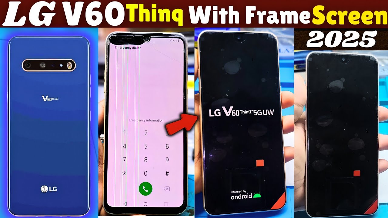 Lg V60 Thinq 5G With Frame Screen 📲 Replacement 2025 ! 💯 Original Panel