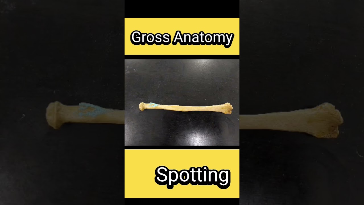 Anatomy Spotting 
