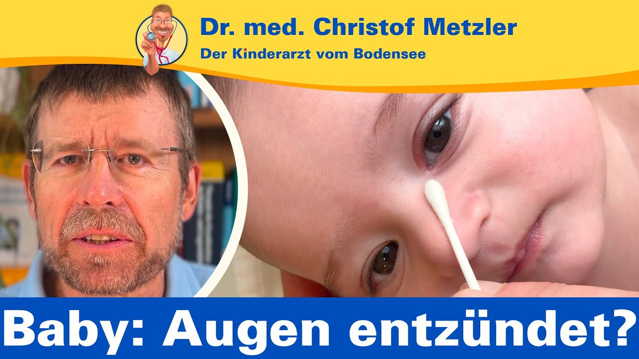 Schmieraugen beim Baby: was tun? – Der Kinderarzt vom Bodensee