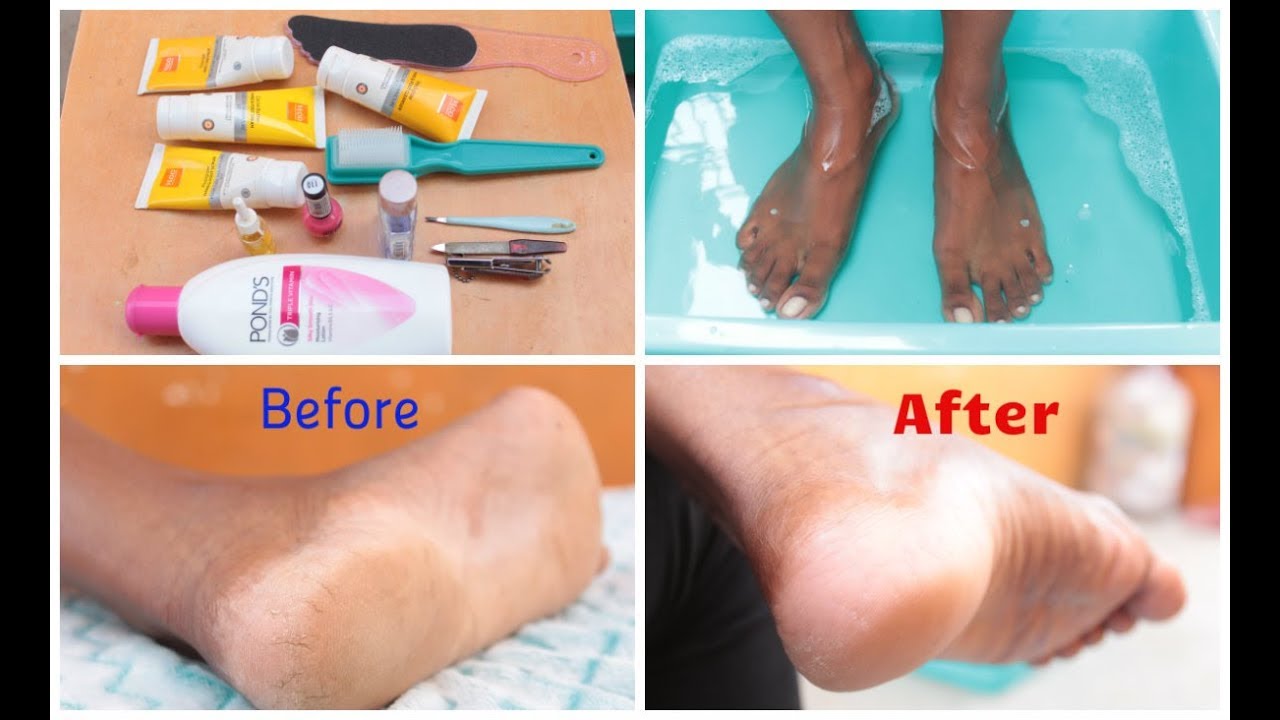 Pedicure வீட்டிலேயே செய்வது எப்படி/குதிகால் வெடிப்பிலிருந்து ஐந்தே நாட்களில் விடுமுறை