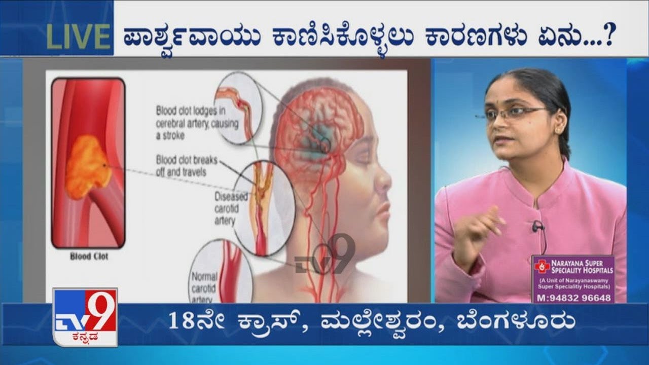 Nimma Doctor | Treatment For Strokes | Narayana Super Specialty Hospitals