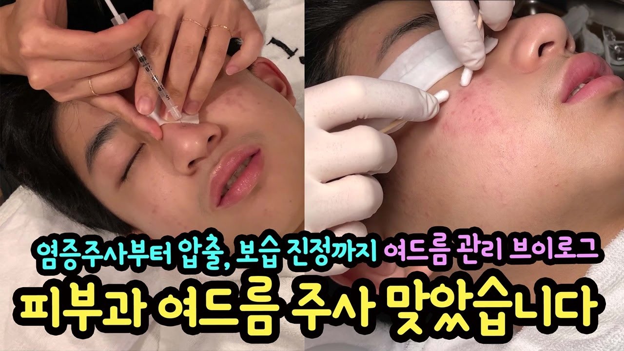 피부과에 가서 여드름 주사 맞고 왔어요 (염증주사부터 압출, 보습 진정까지 여드름 관리 프로그램 풀 영상 브이로그) 마이린 TV
