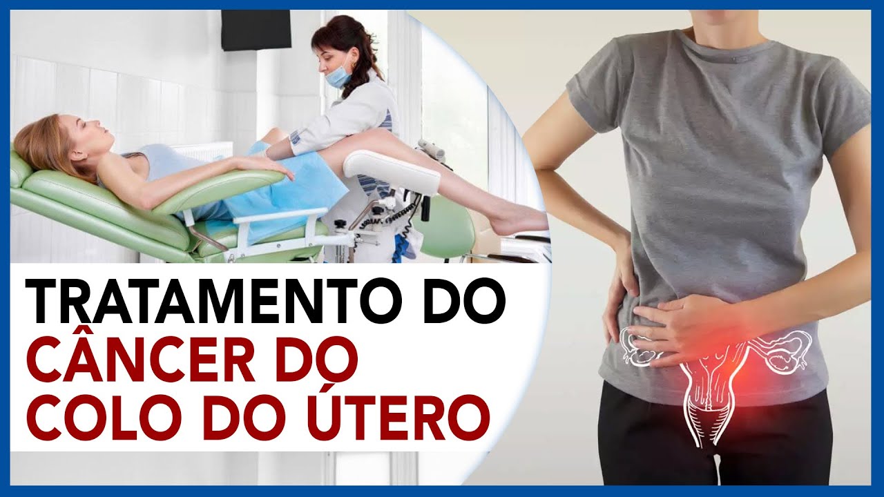 Tratamento do Câncer do Colo do Útero