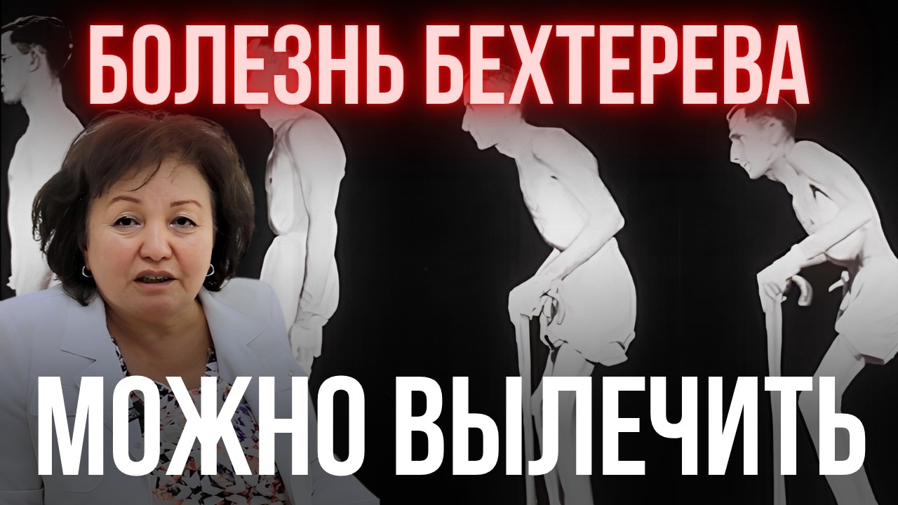 Болезнь Бехтерева МОЖНО ВЫЛЕЧИТЬ!