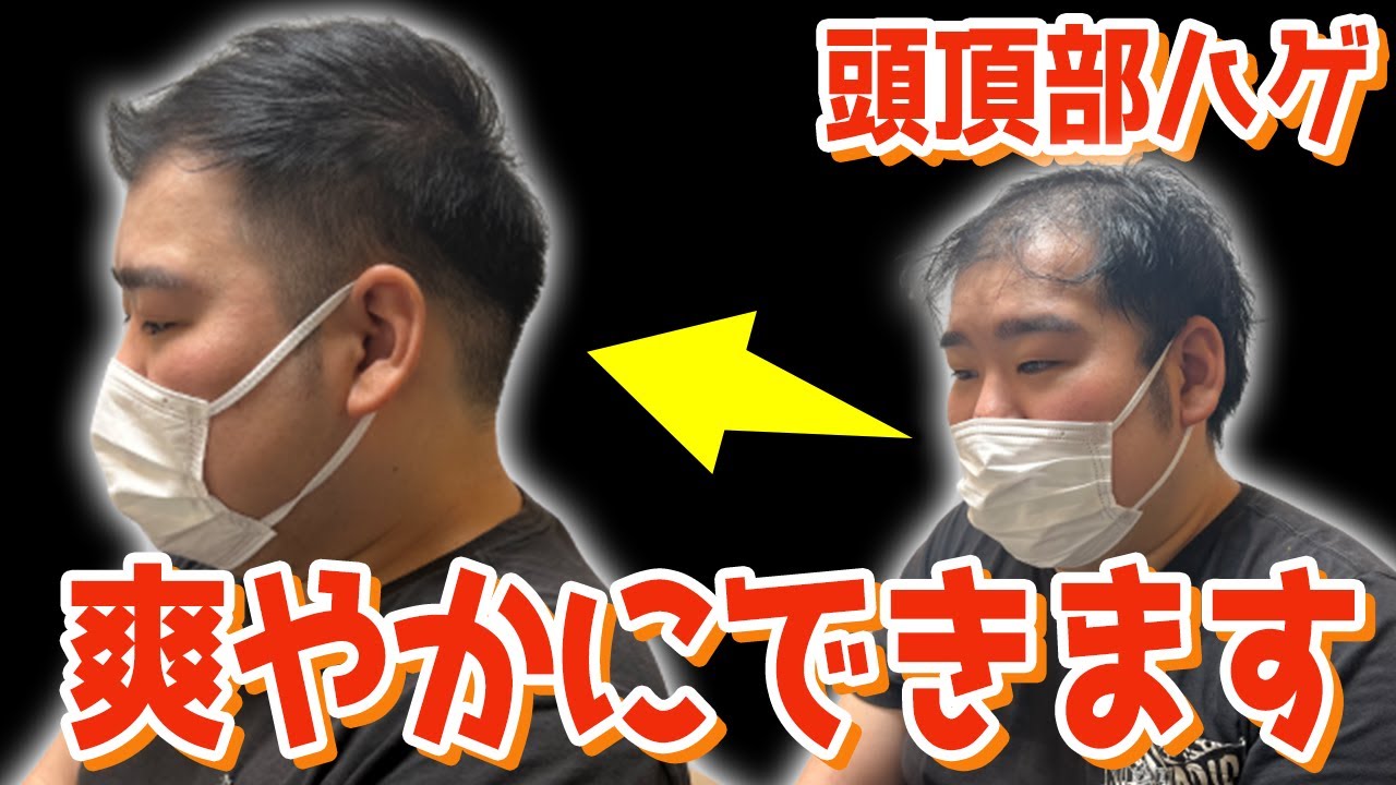 頭頂部の薄さに悩むモデルさんをカットでカバーしていく！