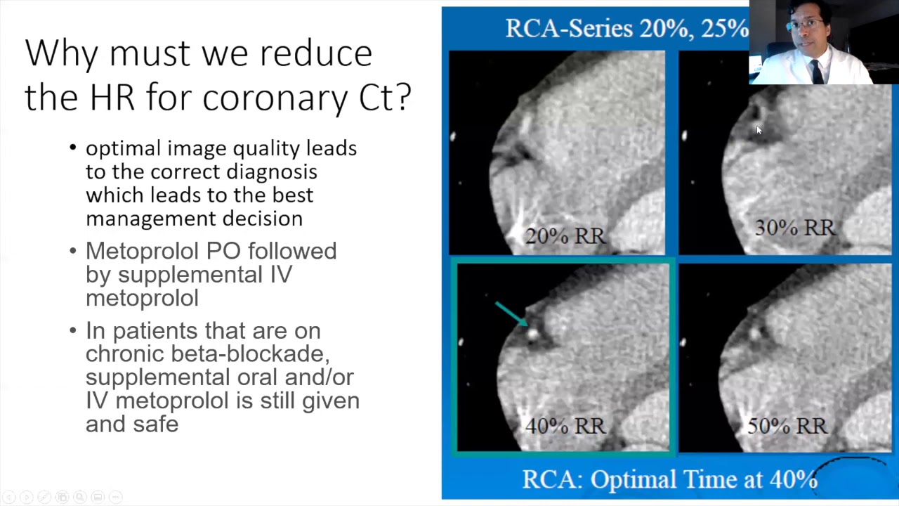 Medications for Cardiac CT