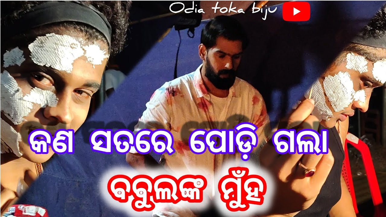 ଯାତ୍ରା ସିଂହବାହିନୀ ହିରୋ ବବୁଲୁ ର face ପୋଡିଯାଇଛି 😭😭 / odia toka biju 