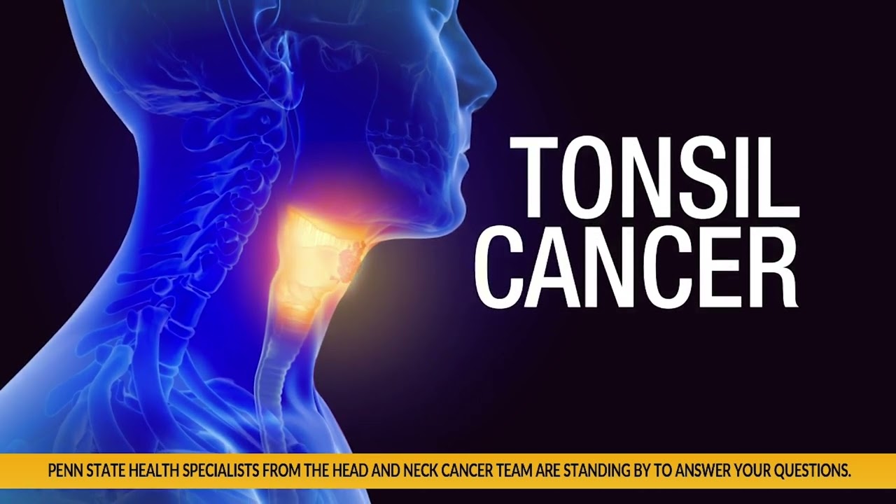 Doug Regester - Tonsil Cancer - Penn State Cancer Institute