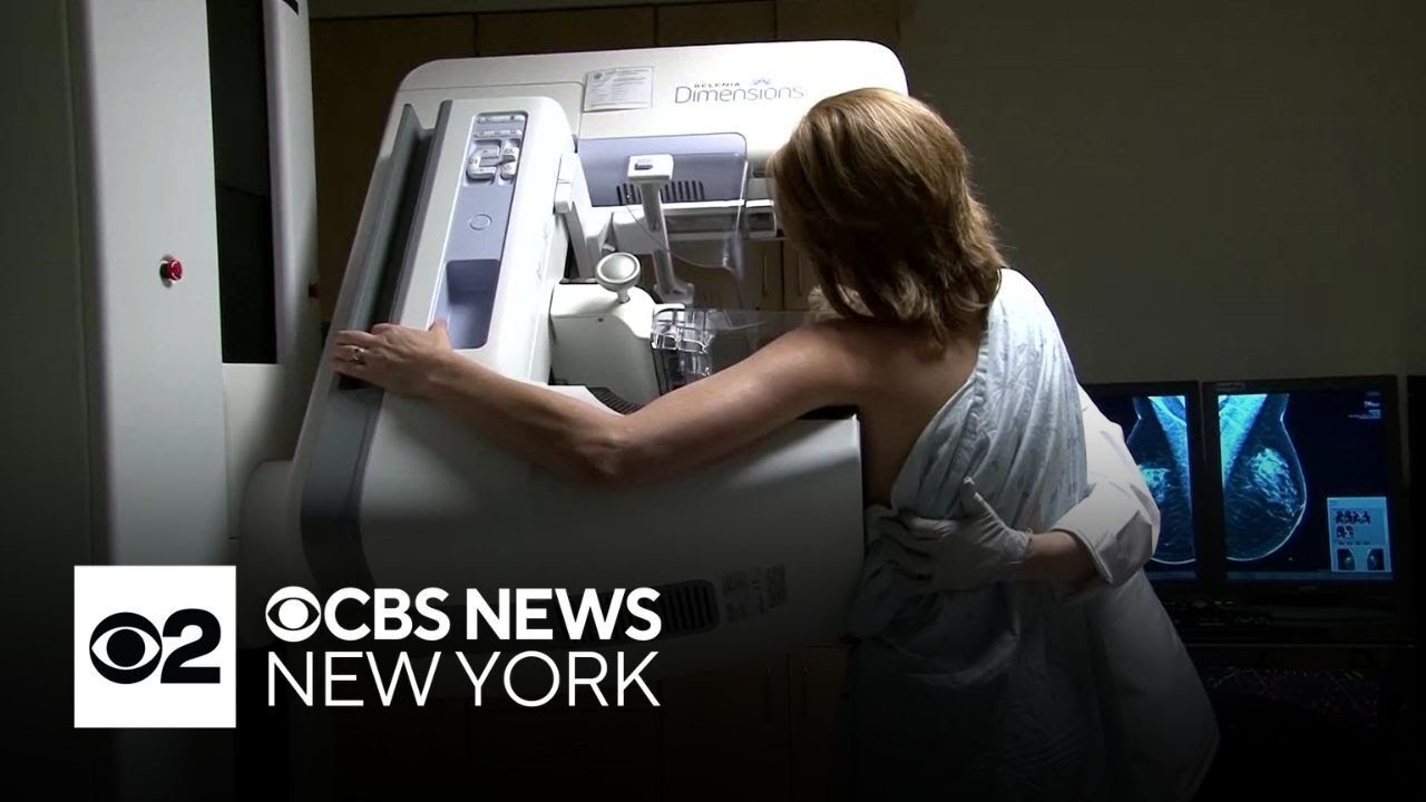 There are new guidelines for how often women should get mammograms