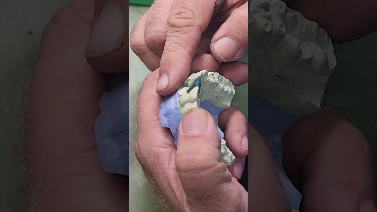 Waxing a pfm crown part 1