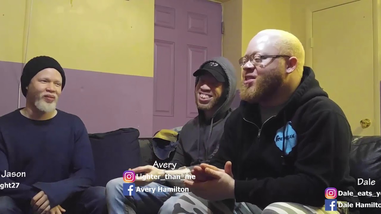 Life with albinism