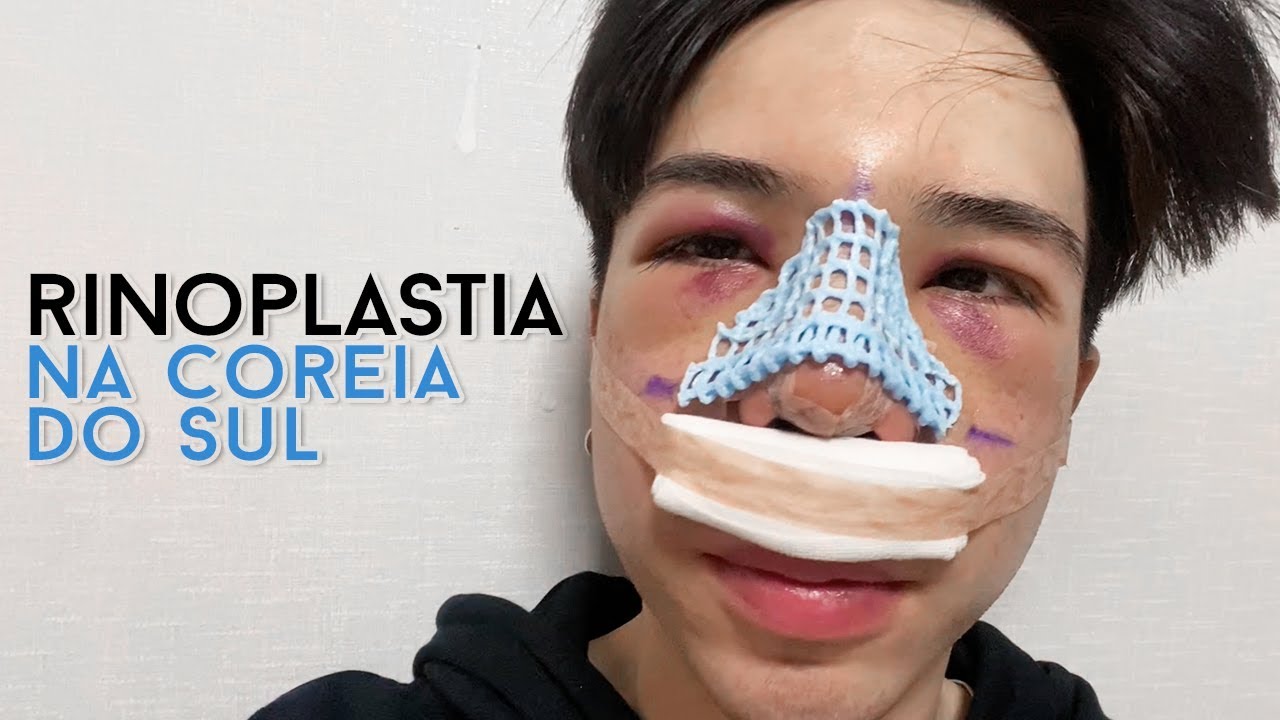 Fiz uma cirurgia plástica na Coreia do Sul | Vlog