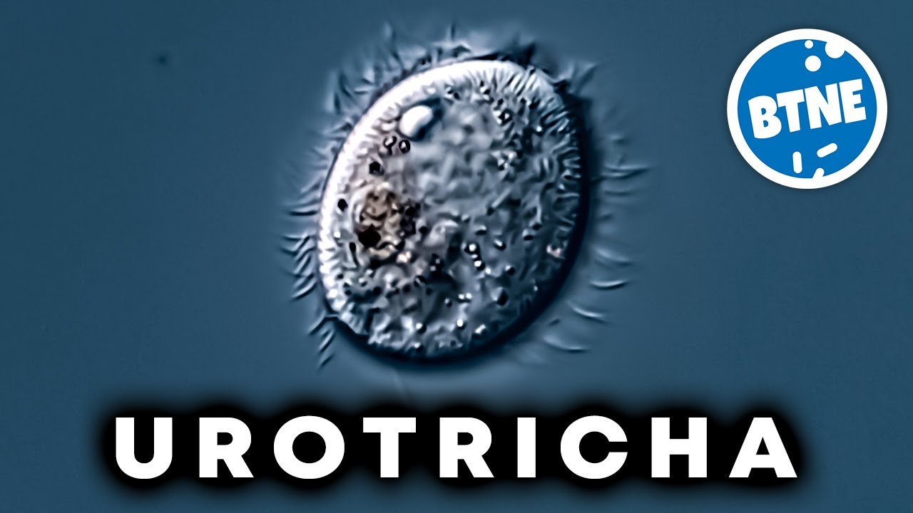 Urotricha Farcta Ciliate Under The Microscope