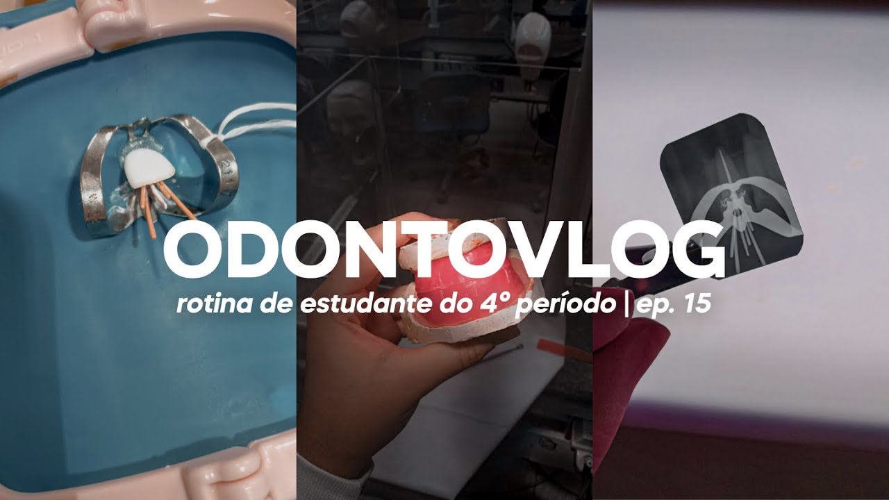 ODONTOVLOG #15: &uacute;ltima aula de pr&oacute;tese, stranger things, endo e biomateriais :) | Odonto Energy