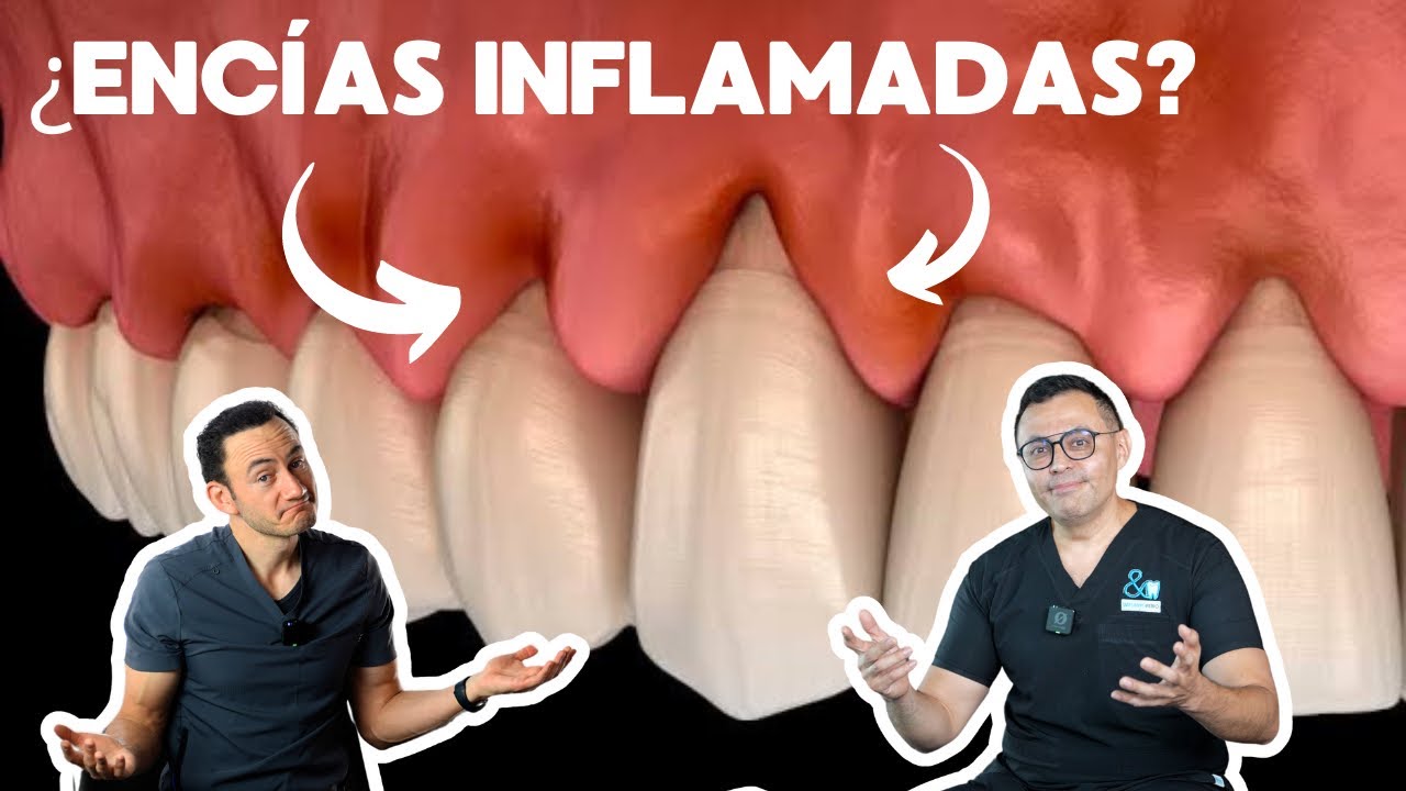 Por esta razón no deja de sangrarte la encía