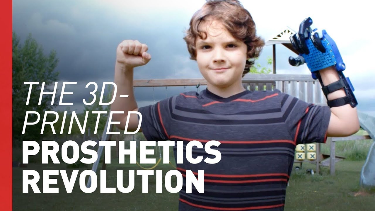 3D-Printed Bionic Hands are Changing Kids' Lives | Freethink Superhuman