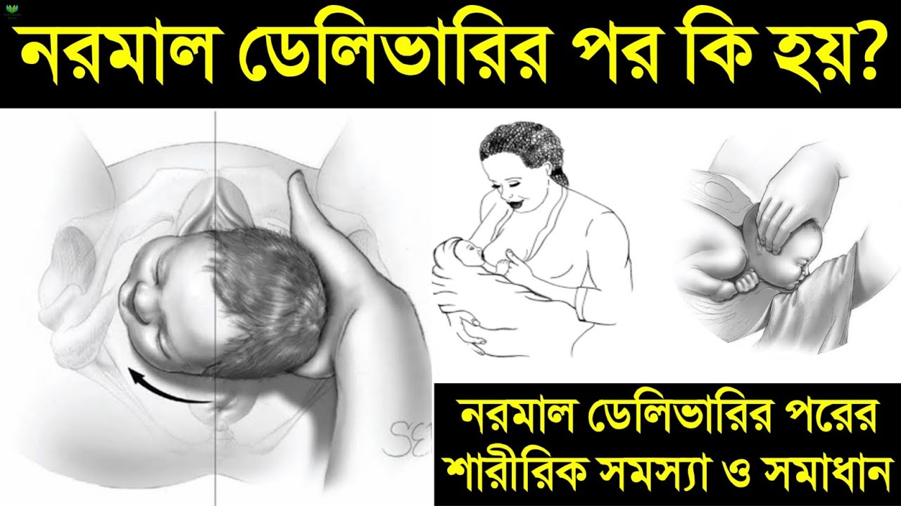 নরমাল ডেলিভারির পর কি কি শারীরিক সমস্যা হয়? | নরমাল ডেলিভারির পর কিভাবে দ্রুত সুস্থ্য হওয়া যায় দেখুন