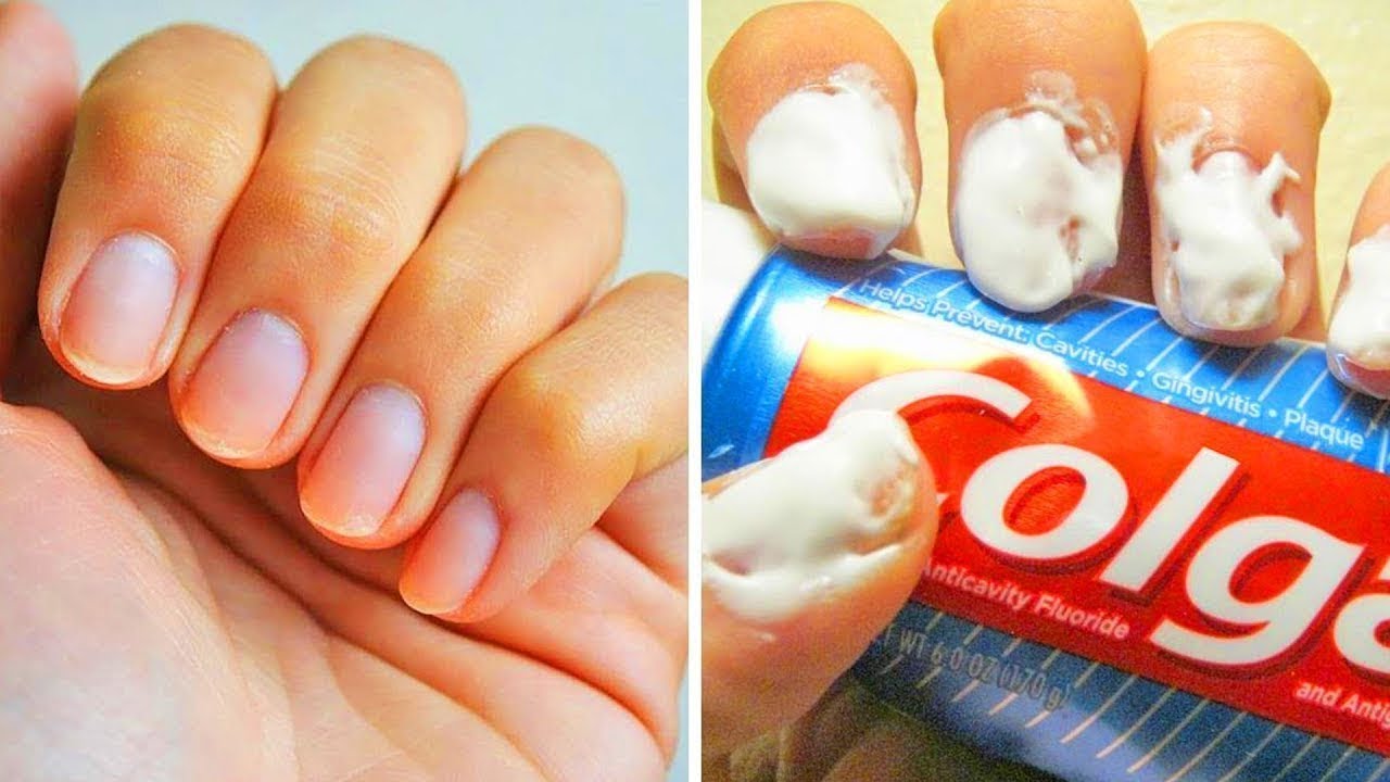 완벽한 손톱을 위한 20가지 쉬운 꿀팁