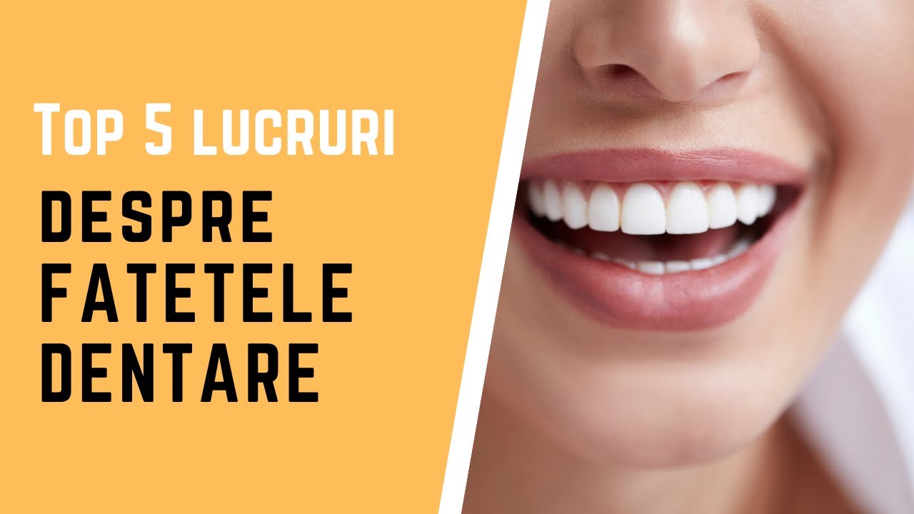Ce sunt fatetele dentare?